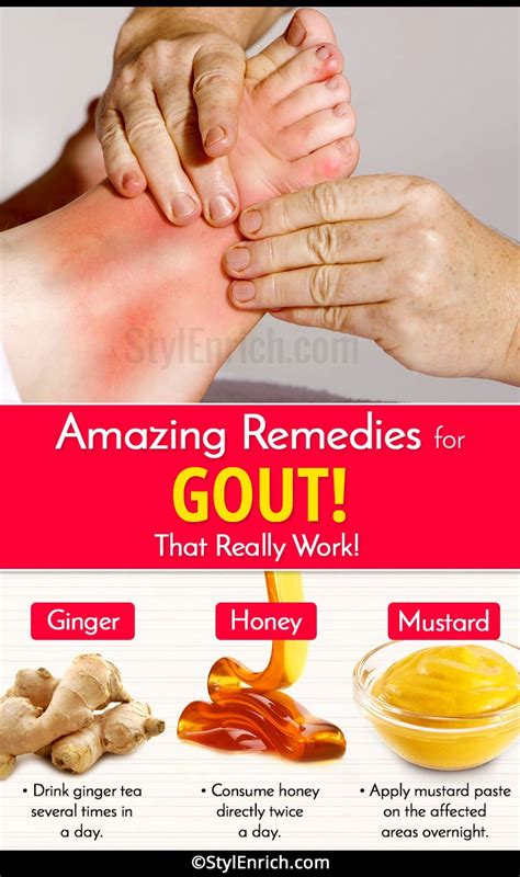 gout home remedies that work.